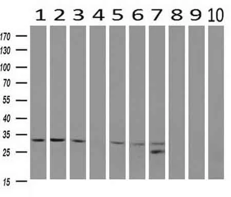 WB analysis of human tissues (Lane 1-Testis ; Lane 2-Omentum ; Lane 3-Uterus ; Lane 4-Breast ; Lane 5-Brain ; Lane 6-Liver ; Lane 7-Ovary ; Lane 8-Thyroid gland ; Lane 9-colon ; Lane 10-spleen) using GTX84696 CDK5 antibody [2H6]. Loading : 10 ug per lane Dilution : 1:200