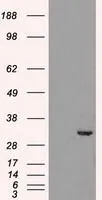 WB analysis of HEK293T cells transfected with CDK5 plasmid (Right) or empty vector (Left) for 48 hrs using GTX84696 CDK5 antibody [2H6]. Loading : 5 ug per lane