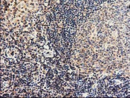 IHC-P analysis of human lymph node tissue using GTX84728 CBWD1 antibody [4E8].
