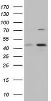 WB analysis of HEK293T cells transfected with CBWD1 plasmid (Right) or empty vector (Left) for 48 hrs using GTX84728 CBWD1 antibody [4E8]. Loading : 5 ug per lane