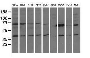 WB analysis of various cell lines using GTX84728 CBWD1 antibody [4E8]. Loading : 35 ug per lane