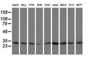 WB analysis of HEK293T cells transfected with CAPZA1 plasmid (Right) or empty vector (Left) for 48 hrs using GTX84736 CAPZA1 antibody [7C8]. Loading : 5 ug per lane