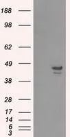 WB analysis of HEK293T cells transfected with CaMKI delta plasmid (Right) or empty vector (Left) for 48 hrs using GTX84738 CaMKI delta antibody [2C6]. Loading : 5 ug per lane