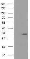 WB analysis of HEK293T cells transfected with C21orf59 plasmid (Right) or empty vector (Left) for 48 hrs using GTX84747 C21orf59 antibody [1A1]. Loading : 5 ug per lane