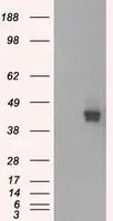 WB analysis of HEK293T cells transfected with CD147 plasmid (Right) or empty vector (Left) for 48 hrs using GTX84800 CD147 antibody [7A7]. Loading : 5 ug per lane