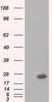 WB analysis of various cell lines using GTX84833 BDH2 antibody [4G4]. Loading : 10 ug per lane Dilution : 1:200
