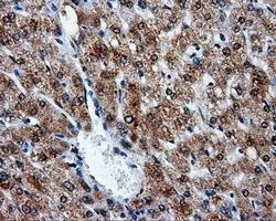 IHC-P analysis of liver tissue using GTX84848 ATP5B antibody [6C4]. Antigen retrieval : Heat-induced epitope retrieval by 10mM citrate buffer, pH6.0, 100oC for 10min. Dilution : 1:50