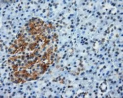 IHC-P analysis of pancreas tissue using GTX84848 ATP5B antibody [6C4]. Antigen retrieval : Heat-induced epitope retrieval by 10mM citrate buffer, pH6.0, 100oC for 10min. Dilution : 1:50