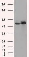 WB analysis of HEK293T cells transfected with ATP5B plasmid (Right) or empty vector (Left) for 48 hrs using GTX84848 ATP5B antibody [6C4]. Loading : 5 ug per lane