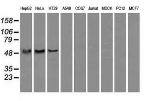 WB analysis of various cell lines using GTX84848 ATP5B antibody [6C4]. Loading : 35 ug per lane