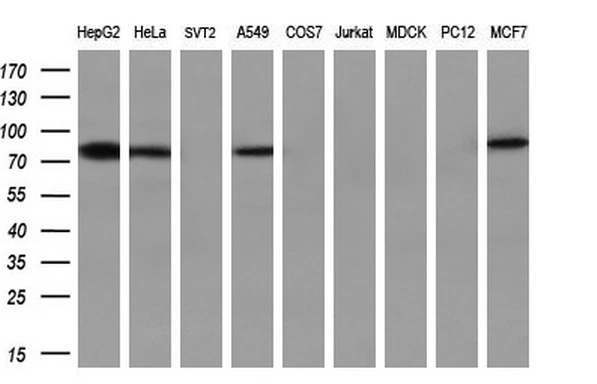 WB analysis of various cell lines using GTX84873 APP antibody [4C3]. Loading : 35 ug per lane Dilution : 1:200