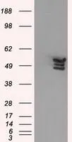 WB analysis of various cell lines using GTX84884 Annexin XI antibody [1C6]. Loading : 10 ug per lane Dilution : 1:200