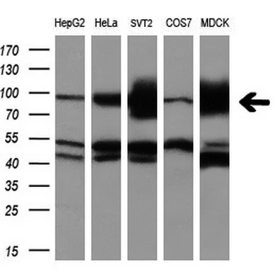 WB analysis of various cell lines using GTX84894 ALDH1L1 antibody [7G6]. Loading : 10 ug per lane Dilution : 1:200