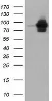 WB analysis of HEK293T cells transfected with ALDH1L1 plasmid (Right) or empty vector (Left) for 48 hrs using GTX84894 ALDH1L1 antibody [7G6]. Loading : 5 ug per lane