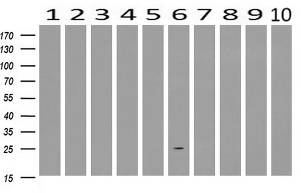 WB analysis of human tissues (Lane 1-Testis ; Lane 2-Omentum ; Lane 3-Uterus ; Lane 4-Breast ; Lane 5-Brain ; Lane 6-Liver ; Lane 7-Ovary ; Lane 8-Thyroid gland ; Lane 9-colon ; Lane 10-spleen) using GTX84931 AK3 antibody [6D6]. Loading : 10 ug per lane Dilution : 1:200