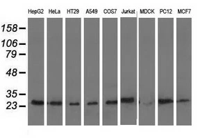 WB analysis of various cell lines using GTX84931 AK3 antibody [6D6]. Loading : 35 ug per lane