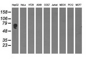 WB analysis of various cell lines using GTX84950 Alpha fetoprotein / AFP antibody [3B5]. Loading : 35 ug per lane