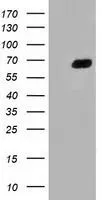 WB analysis of HEK293T cells transfected with Alpha fetoprotein / AFP plasmid (Right) or empty vector (Left) for 48 hrs using GTX84953 Alpha fetoprotein / AFP antibody [1E8]. Loading : 5 ug per lane