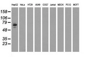 WB analysis of various cell lines using GTX84953 Alpha fetoprotein / AFP antibody [1E8]. Loading : 35 ug per lane
