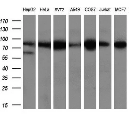 WB analysis of various cell lines using GTX84965 Aconitase 2 antibody [7G4]. Loading : 10 ug per lane Dilution : 1:200
