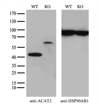 ICC/IF analysis of COS7 cells transiently transfected with ACAT2 plasmid using GTX84977 ACAT2 antibody [1C5].
