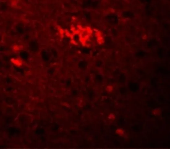 IHC-P analysis of human brain tissue using GTX85001 TRIM71 antibody. Working concentration : 20 microg/ml