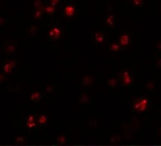 ICC/IF analysis of K562 cells using GTX85011 FRMPD1 antibody. Working concentration : 20 microg/ml