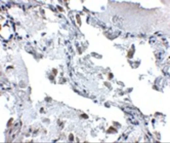IHC-P analysis of human lung tissue using GTX85017 SH3BP4 antibody. Working concentration : 5 microg/ml IHC-P analysis of human lung tissue using GTX85017 SH3BP4 antibody. Working concentration : 5 microg/ml