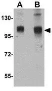 WB analysis of rat lung tissue lysate using GTX85017 SH3BP4 antibody. Working concentration : (A) 1 and (B) 2 microg/ml