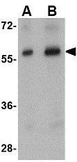 IHC-P analysis of human brain tissue using GTX85023 STK39 antibody. Working concentration : 2.5 ug/ml
