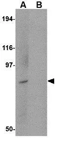 WB analysis of Daudi cell lysate in (A) the absence and (B) the presence of blocking peptide using GTX85029 BICD1 antibody. Working concentration : 1 microg/ml WB analysis of Daudi cell lysate in (A) the absence and (B) the presence of blocking peptide using GTX85029 BICD1 antibody. Working concentration : 1 microg/ml