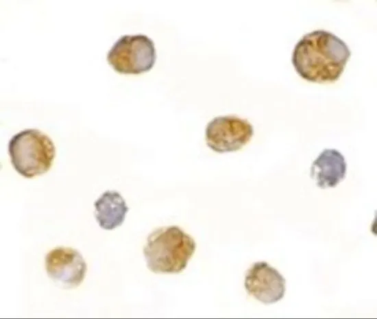 ICC/IF analysis of Daudi cells using GTX85029 BICD1 antibody. Working concentration : 2.5 microg/ml