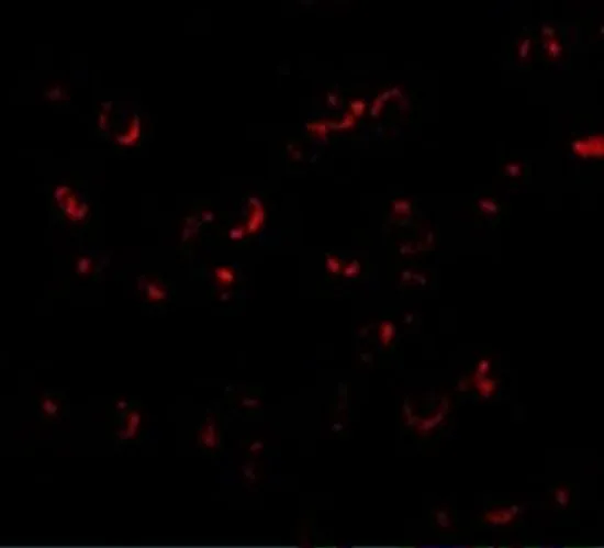 ICC/IF analysis of Daudi cells using GTX85029 BICD1 antibody. Working concentration : 20 microg/ml