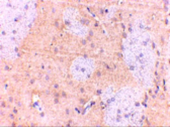 IHC-P analysis of mouse brain tissue using GTX85034 GPAM antibody. Working concentration : 5 ug/ml