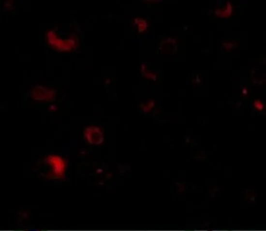 IHC-P analysis of human brain tissue using GTX85035 RIM2 antibody. Working concentration : 20 microg/ml