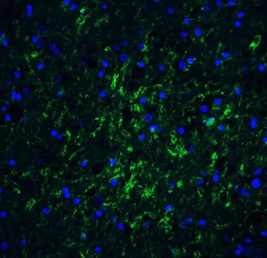 IHC-P analysis of human brain tissue using GTX85039 IRGM antibody. Working concentration : 20 microg/ml IHC-P analysis of human brain tissue using GTX85039 IRGM antibody. Working concentration : 20 microg/ml