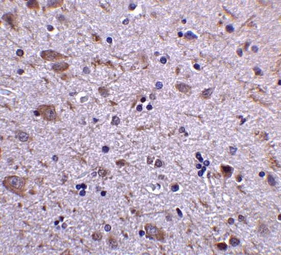 IHC-P analysis of human thymus tissue using GTX85039 IRGM antibody. Working concentration : 5 microg/ml