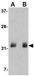 WB analysis of NIH 3T3 cell lysate using GTX85040 FGF4 antibody. Working concentration : (A) 0.5 and (B) 1 microg/ml WB analysis of NIH 3T3 cell lysate using GTX85040 FGF4 antibody. Working concentration : (A) 0.5 and (B) 1 microg/ml