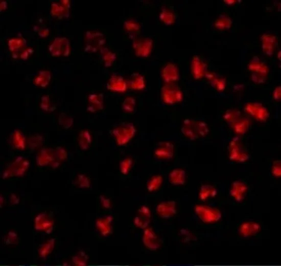 ICC/IF analysis of 3T3 cells using GTX85040 FGF4 antibody. Working concentration : 2.5 microg/ml