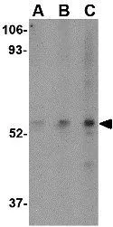 WB analysis of HeLa cell lysate using GTX85042 SP110 antibody. Working concentration : (A) 0.5, (B) 1, and (C) 2 microg/ml