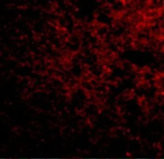 IHC-P analysis of human brain tissue using GTX85042 SP110 antibody. Working concentration : 50 microg/ml