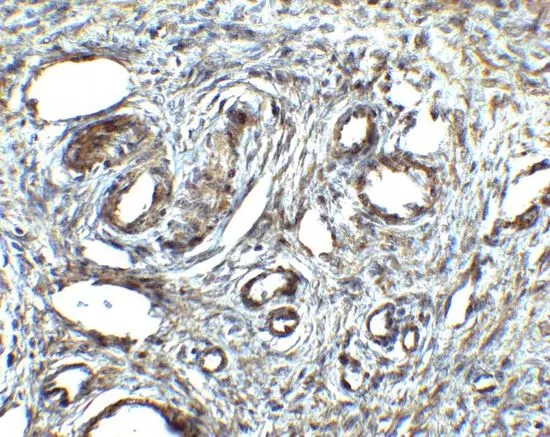 IHC-P analysis of human ovary tissue using GTX85048 Orai1 antibody. Working concentration : 2.5 microg/ml