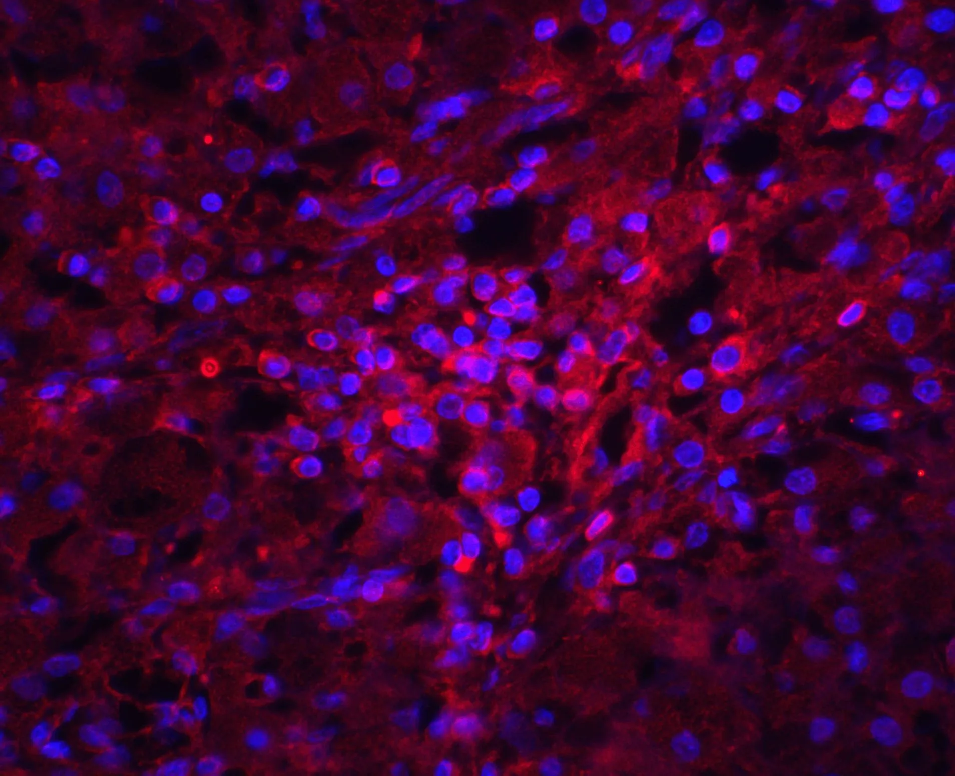 IHC-P analysis of human ovary tissue using GTX85048 Orai1 antibody. Red : Primary antibody Blue : DAPI Dilution : 20 microg/ml