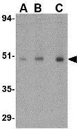 WB analysis of human ovary tissue lysate using GTX85048 Orai1 antibody. Working concentration : (A) 0.5, (B) 1, and (C) 2 microg/ml
