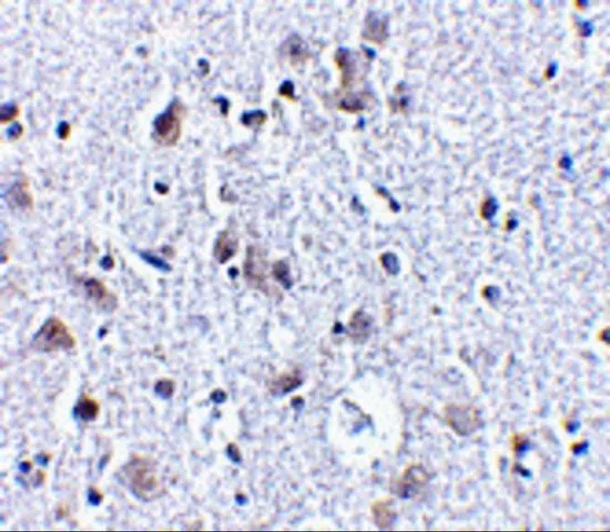 IHC-P analysis of human brain tissue using GTX85055 BRSK1 antibody. Working concentration : 2.5 microg/ml IHC-P analysis of human brain tissue using GTX85055 BRSK1 antibody. Working concentration : 2.5 microg/ml