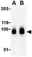 WB analysis of human brain tissue lysate using GTX85055 BRSK1 antibody. Working concentration : (A) 0.5 and (B) 1 microg/ml