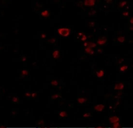 ICC/IF analysis of human brain cells using GTX85055 BRSK1 antibody. Working concentration : 20 microg/ml