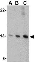 ICC/IF analysis of K562 cells using GTX85064 PEN2 antibody. Working concentration : 20 ug/ml