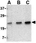 IHC-P analysis of human spleen tissue using GTX85066 MD1 antibody. Working concentration : 2 ug/ml