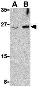 WB analysis of Jurkat cell lysate using GTX85069 IL32 antibody. Working concentration : (A) 2.5 and (B) 5 microg/ml WB analysis of Jurkat cell lysate using GTX85069 IL32 antibody. Working concentration : (A) 2.5 and (B) 5 microg/ml